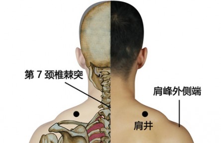 ​健康问答 | 缓解颈椎“职业病”，如何进行中医调理？