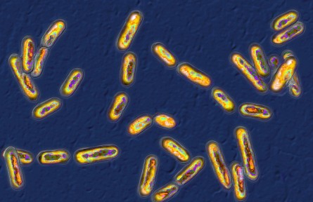 科技名词 | 革兰氏染色  Gram staining