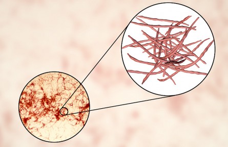 科技名词 | 放线菌  Actinomycete