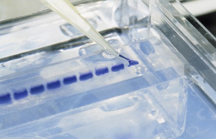 科技名词|琼脂糖凝胶电泳  agarose gel electrophoresis