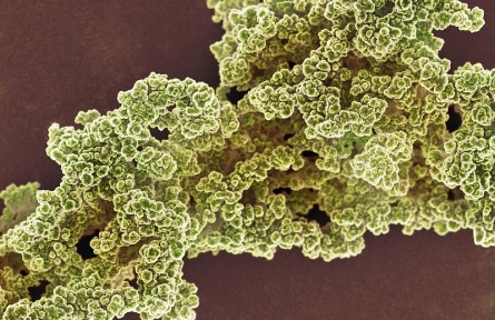 科技名词 | 细胞外基质 extracellular matrix