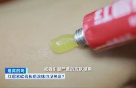 别再乱用“红霉素软膏”和“红霉素眼膏”了
