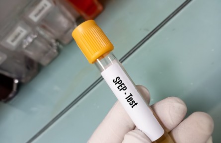 科技名词|血清蛋白电泳 serum protein electrophoresis