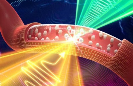 太赫兹+声波！我国科学家使无针血钠检测成为可能