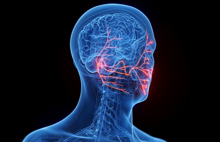 科技名词|三叉神经痛 trigeminal neuralgia