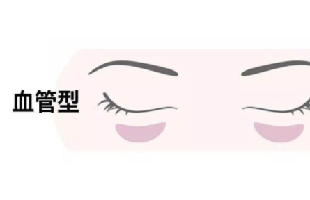 睡眠时间充足黑眼圈依旧不消？找准成因科学改善眶周暗沉